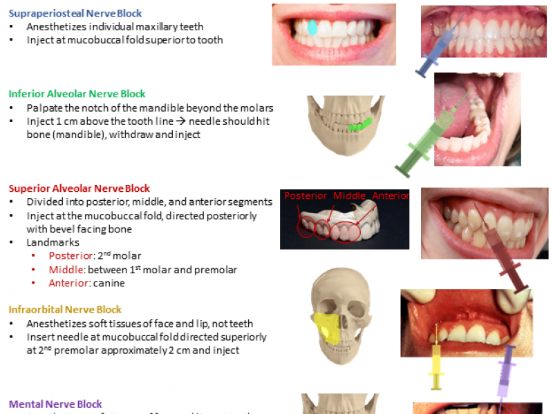 Back to Basics: Dental Blocks