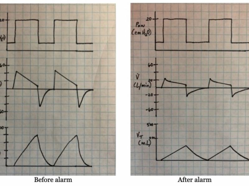 #Name that Mode…and a ventilator alarm is firing!