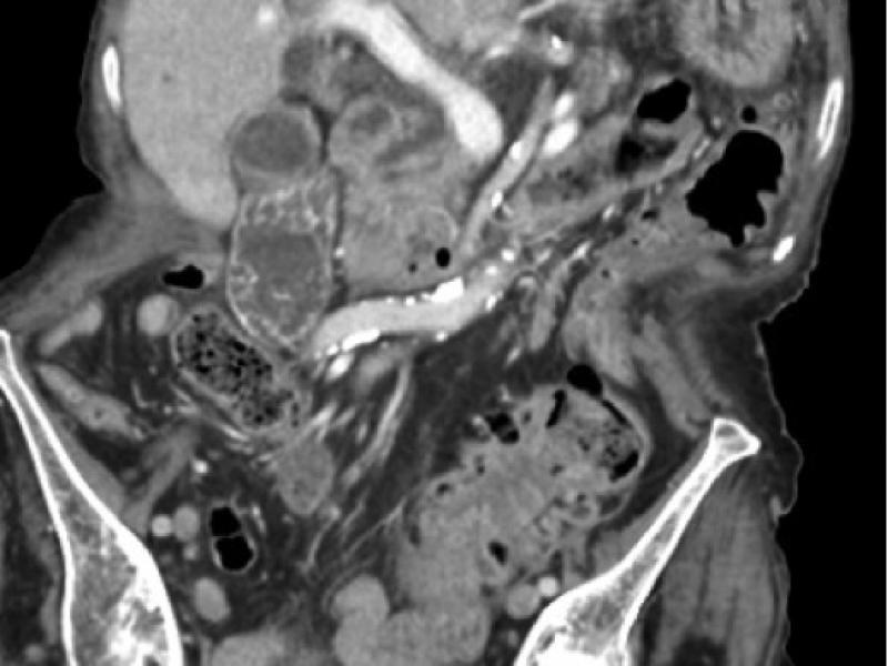 What's the Diagnosis? By Dr. Lauren Murphy