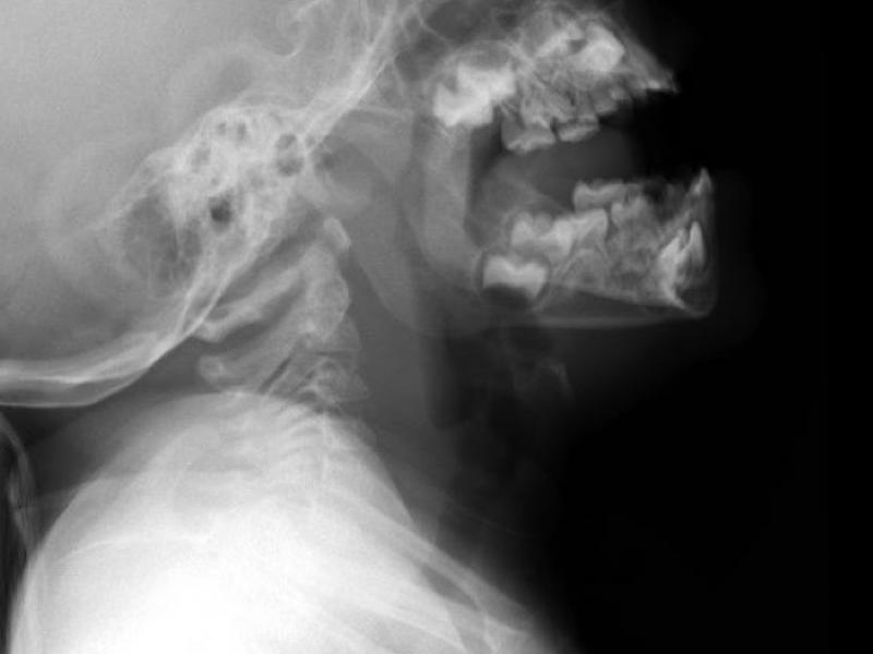 What's the diagnosis? By Dr. Katie Selman