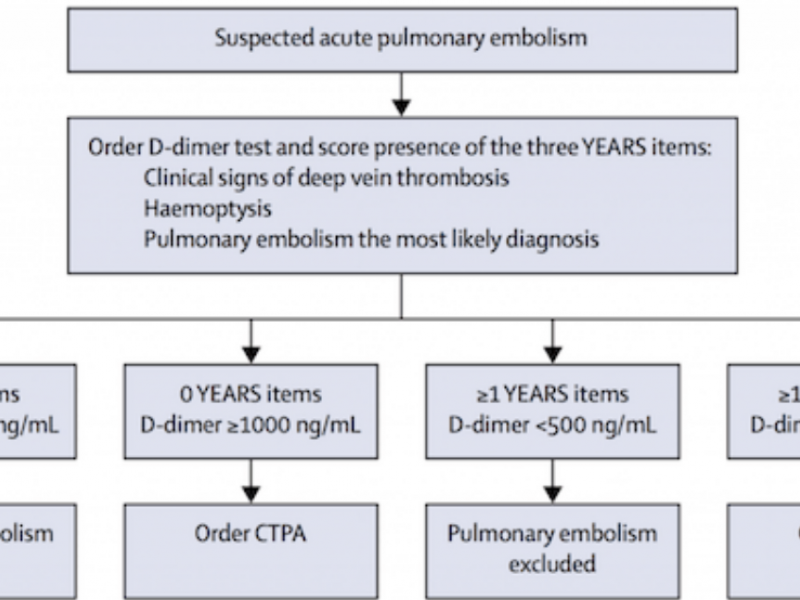 #EMConf: The YEARS Algorithm