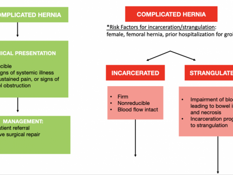 Hernia basics