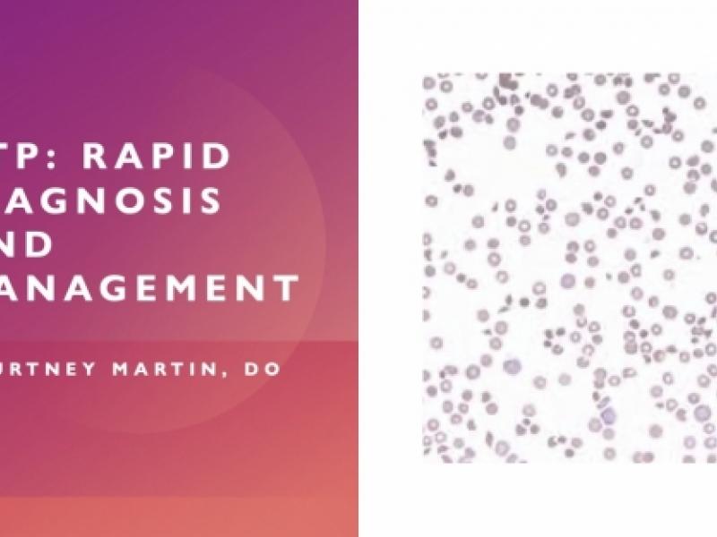 TTP: Rapid diagnosis and management 
