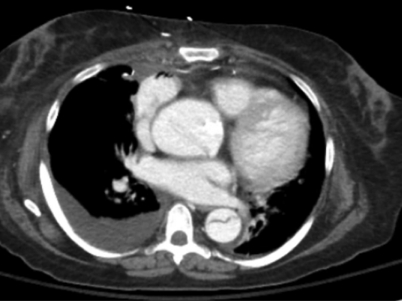 What's the Diagnosis? By Sarab Sodhi