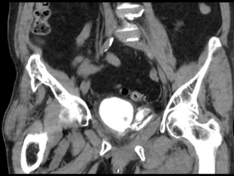 What's the diagnosis? By Dr. Katie Selman