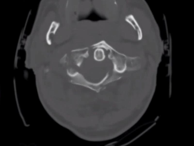 What's the diagnosis? By Dr. Lynn Manganiello