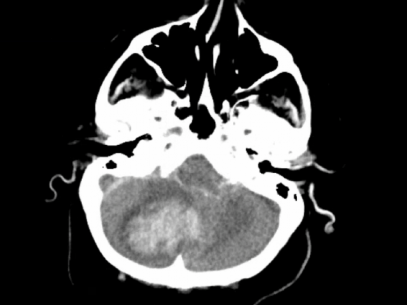 What's the diagnosis? By Dr. Loran Hatch