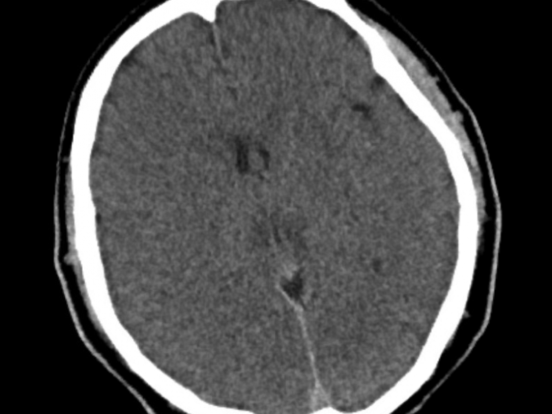 What's the Diagnosis? By Dr. Sarab Sodhi