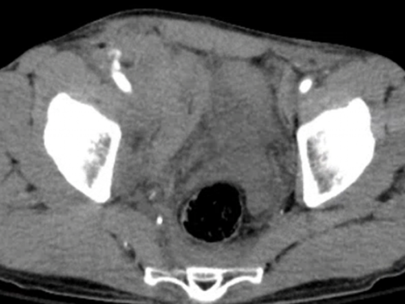 What's the Diagnosis? By Dr. Lauren Murphy