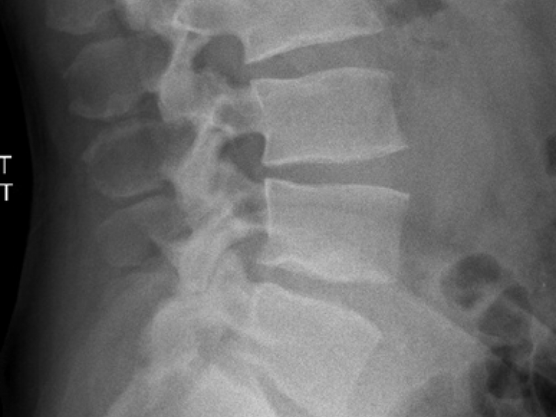 Critical Cases - Back Pain Nightmare Diagnosis!