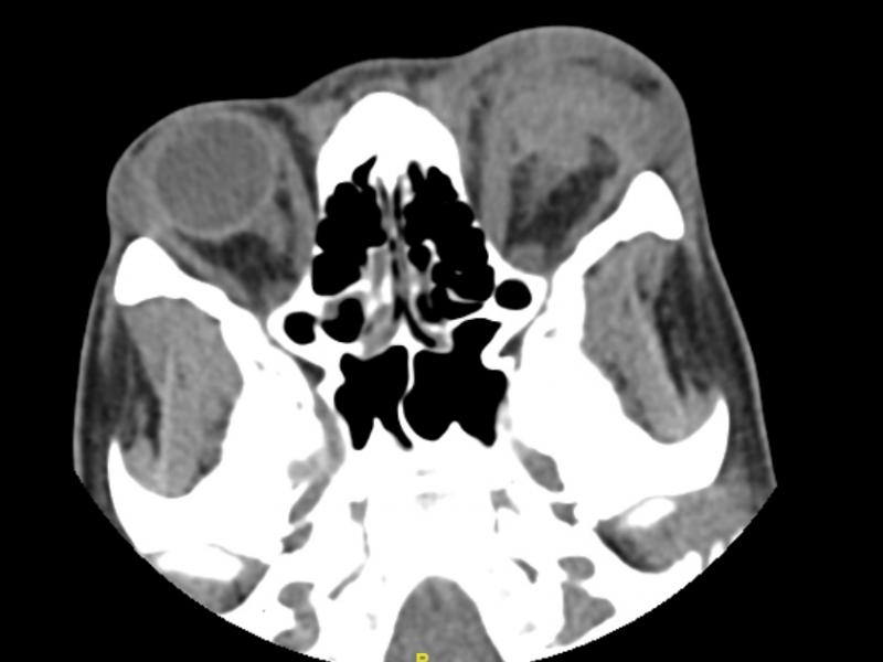 What's the diagnosis?  By Dr. Angela Ugorets