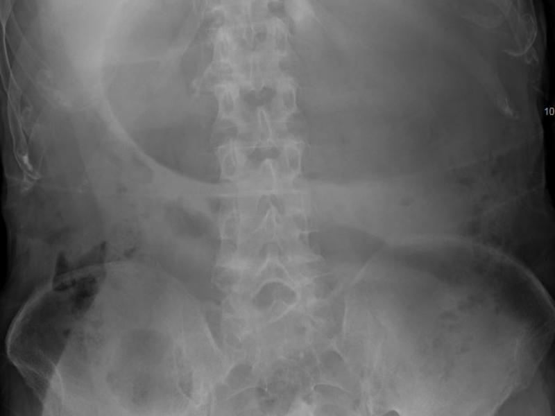 What's the Diagnosis? By Dr. Katie Selman