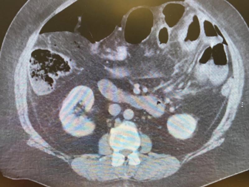 What's the diagnosis?  By Dr. Charlie Ingram