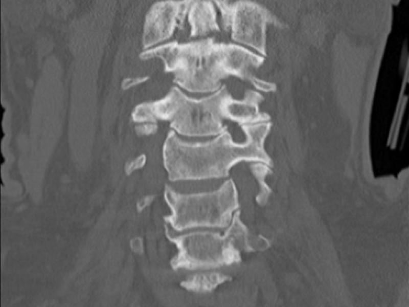 What's the diagnosis? By Dr. Eric Chavis