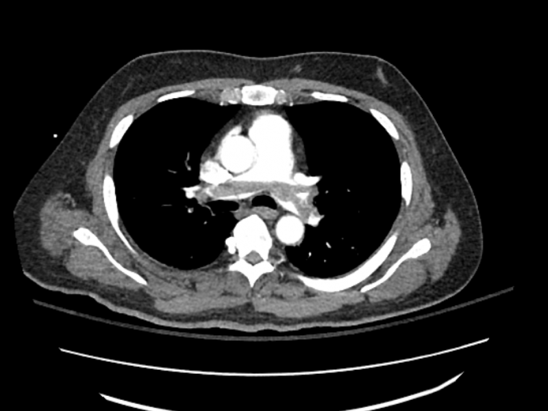 What's the diagnosis?  By Dr. Angela Ugorets