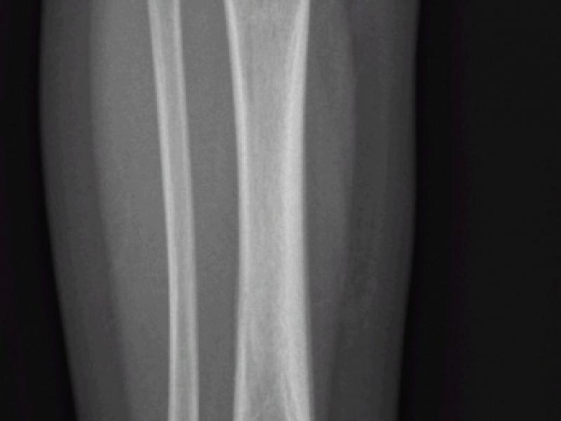 What's the Diagnosis? By Dr. Michael Tom