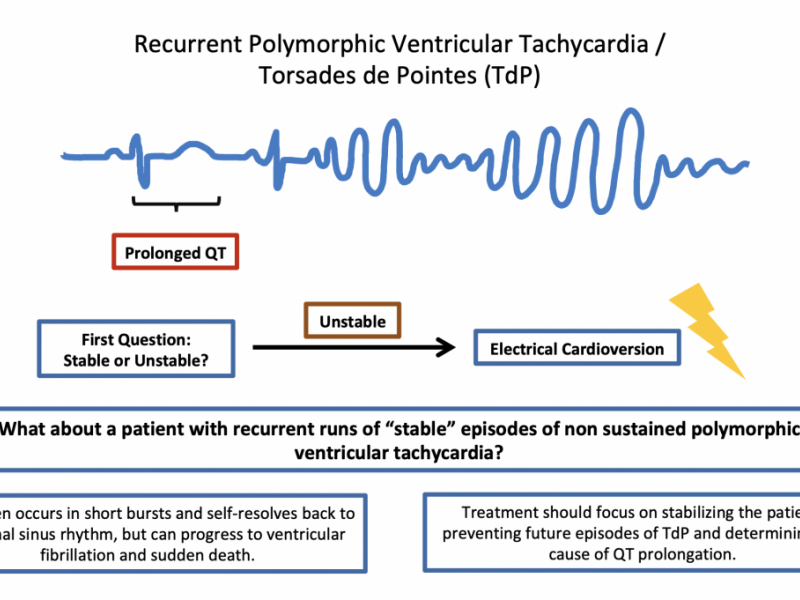 Back to Basics: Recurrent Polymorphic VT/Torsades de Pointes